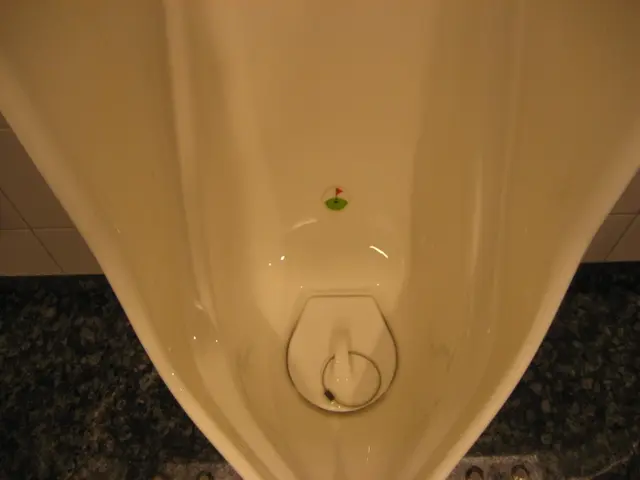 Foul-Smelling Urine: Interpreting the Significance