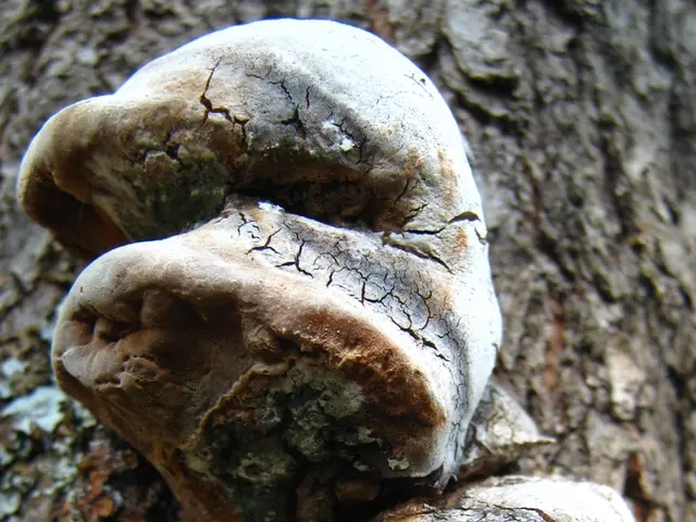 Fungal Sinus Infections: Their Symptoms, Origin, Varieties, and Remedies